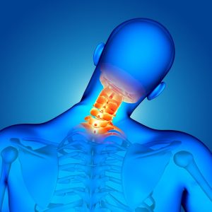 Stem Cell Treatment for Neck Pain