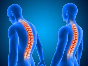 Stem Cell Treatment for Neck Pain