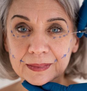 stem cell treatment for wrinkles