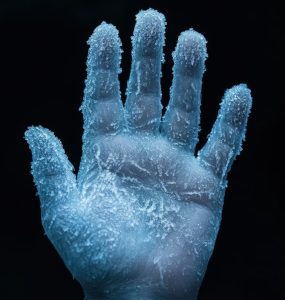 stem cell treatment for arthritis in hands