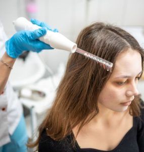topical stem cell treatment for hair loss