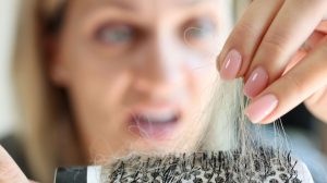 topical stem cell treatment for hair loss
