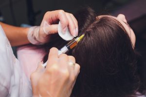 hair regrowth stem cell treatment