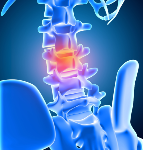 stem cell treatment for lower back pain