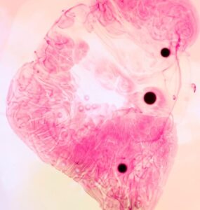 Stem Cell Liver Treatment