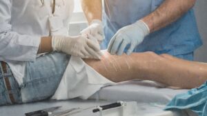 stem cell scar treatment