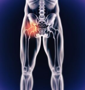 Sacroiliac Joint Stem Cell Treatment