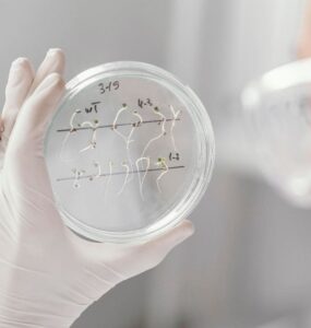 Stem Cell Treatment for PPMS