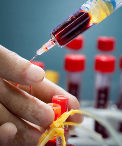 Cord Blood Stem Cell Treatment