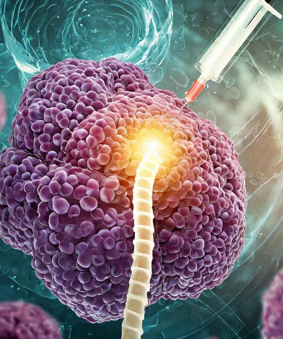 A New Horizon in Transverse Myelitis Treatment