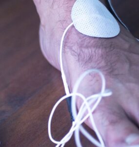 Stem Cell Treatment for Neuropathy
