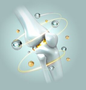 Stem Cell Treatment for Osteoarthritis
