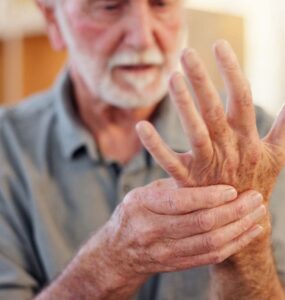 stem cells rheumatoid arthritis treatment