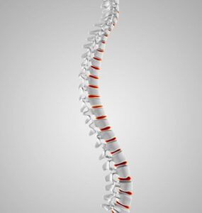 Spinal Stenosis Treatment