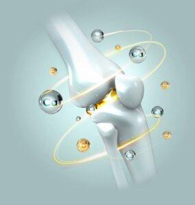 Chondromalacia Stem Cell Treatment