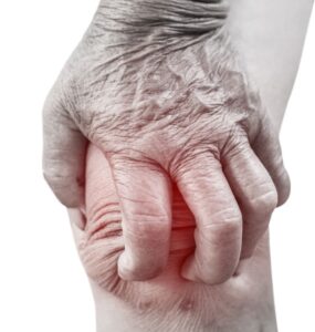 stem cells rheumatoid arthritis treatment