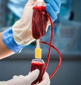 Cord Blood Stem Cell Treatment