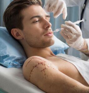 stem cell scar treatment
