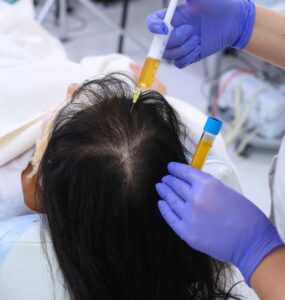 capillary hair treatment