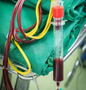 Cord Blood Stem Cell Treatment