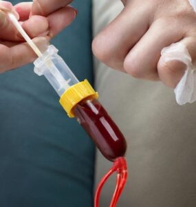 Cord Blood Stem Cell Treatment