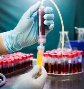 Cord Blood Stem Cell Treatment