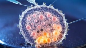 stem cell treatment for disc degeneration