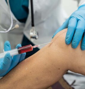 stem cells treatment cost