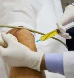 stem cells treatment cost