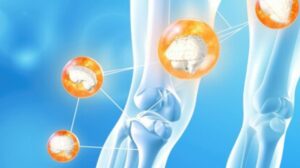 Stem Cell Treatment for Joints