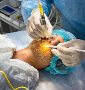 stem cell treatment for tmj