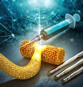 stem cell treatment for thyroid