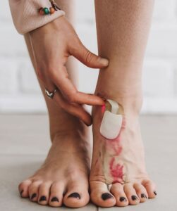Stem Cell Treatment for Neuropathy