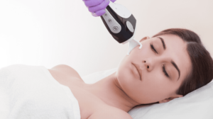 Cryo Stem Cell Facial Treatment