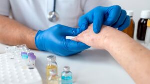 stem cells rheumatoid arthritis treatment