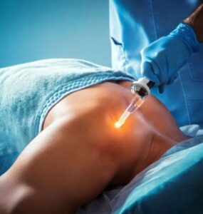full body stem cell treatment