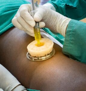 lumbar disc treatment