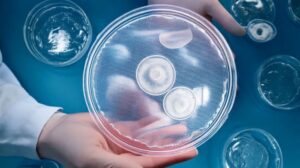 placenta stem cell treatment