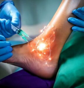 stem cell treatment for achilles tendon rupture
