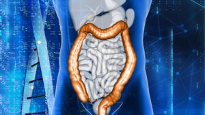 Stem Cell Treatment for Crohn's