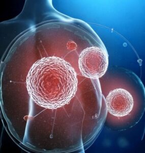 stem cell treatment for tbi