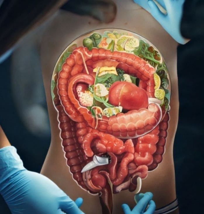 Stem Cell Pathways for Ulcerative Colitis: Your Patient Guide - https ...