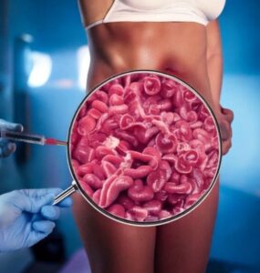 stem cell treatment for ulcerative colitis