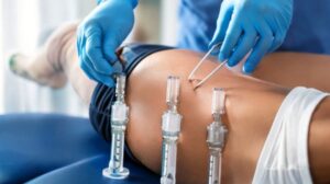 Stem Cell Treatment for Weight Loss
