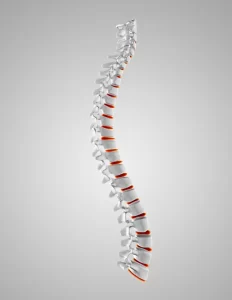 Stem Cell Treatment for Scoliosis Treatment