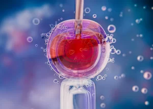 ADHD Stem Cell Treatment
