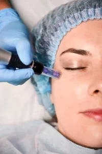 Regencord Cryo Stem Cell Facial for Sensitive Skin Treatment